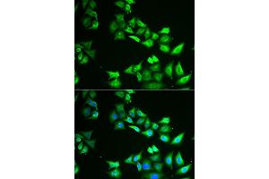 Immunofluorescence analysis of HeLa cell using CCBL1 antibody. (CCBL1 抗体)