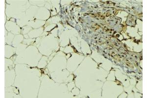 ABIN6278791 at 1/100 staining Human lung tissue by IHC-P. (MBIP 抗体  (Internal Region))