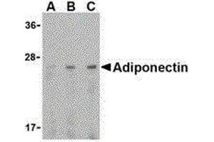 Western Blotting (WB) image for anti-Adiponectin (ADIPOQ) (C-Term) antibody (ABIN2477286) (ADIPOQ 抗体  (C-Term))