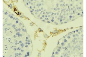 ABIN6277626 at 1/100 staining Mouse testis tissue by IHC-P. (Kallikrein 7 抗体  (Internal Region))