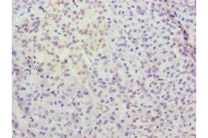 Immunohistochemistry of paraffin-embedded human pancreatic tissue using ABIN7159667 at dilution of 1:100 (METTL25 抗体  (AA 206-455))