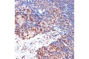 Immunohistochemistry of paraffin-embedded mouse spleen using  Rabbit mAb (ABIN3016894, ABIN3016895, ABIN3016896, ABIN1679361 and ABIN1679362) at dilution of 1:100 (40x lens). (ALOX5 抗体)