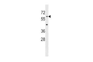 AOAH Antibody (Center) (ABIN1537935 and ABIN2848953) western blot analysis in mouse liver tissue lysates (35 μg/lane). (AOAH 抗体  (AA 168-197))