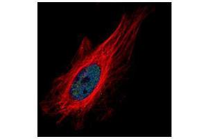 ICC/IF Image Confocal immunofluorescence analysis (Olympus FV10i) of paraformaldehyde-fixed HeLa, using ZNF449, antibody (Green) at 1:500 dilution. (ZNF449 抗体)