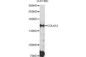 Western blot analysis of extracts of U-87 MG cells, using COL4A1 Antibody (ABIN4903336) at 1:3000 dilution. (COL4A1 抗体)