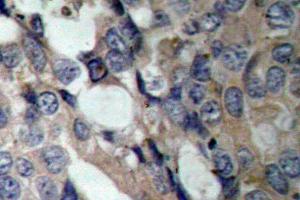Image no. 1 for anti-Heat Shock 27kDa Protein 1 (HSPB1) antibody (ABIN265470) (HSP27 抗体)