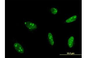 Immunofluorescence of monoclonal antibody to MEF2A on HeLa cell.