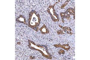 IHC analysis of TOMM34 using anti-TOMM34 antibody (ABIN7599253).