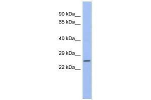 ZNRF1 antibody used at 0. (ZNRF1 抗体  (N-Term))