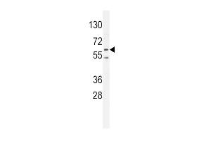 PRK (Thr172) Antibody (ABIN654800 and ABIN2844475) western blot analysis in K562 cell line lysates (35 μg/lane). (PRKAA2 抗体  (Thr172))