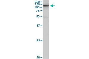 SALF monoclonal antibody (M01), clone 5F12. (GTF2A1 抗体  (AA 141-249))