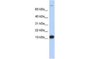 WB Suggested Anti-FABP3 Antibody Titration:  0. (FABP3 抗体  (Middle Region))