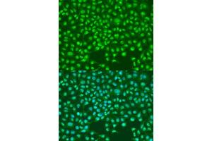 Immunofluorescence analysis of U2OS cells using SKP2 antibody (ABIN6134429, ABIN6147821, ABIN6147823 and ABIN6214002) at dilution of 1:100. (SKP2 抗体)