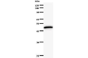 Western Blotting (WB) image for anti-K(lysine) Acetyltransferase 5 (KAT5) antibody (ABIN931130)