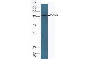 Lane 1: mouse lung lysates Lane 2: mouse kidney lysates probed with Anti-BMX (Tyr566) Polyclonal Antibody, Unconjugated  at 1:5000 90min in 37˚C. (BMX 抗体  (pTyr566))