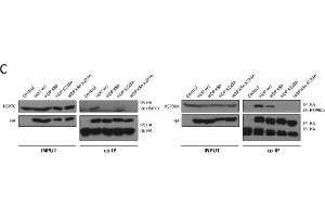 Western Blotting (WB) image for anti-Heat Shock Protein 70 (HSP70) antibody (ABIN361708)