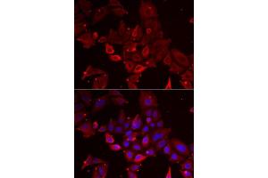 Immunofluorescence analysis of U2OS cells using MYOT antibody. (Myotilin 抗体  (AA 259-314))