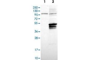 Western Blot analysis of Lane 1: negative control (vector only transfected HEK293T cell lysate) and Lane 2: over-expression lysate (co-expressed with a C-terminal myc-DDK tag in mammalian HEK293T cells) with USP2 polyclonal antibody . (USP2 抗体)