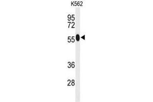 Western blot analysis of ACSM1 Antibody (N-term) in K562 cell line lysates (35µg/lane). (ACSM1 抗体  (N-Term))