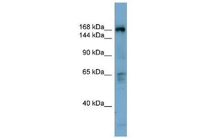 Western Blot showing DOCK2 antibody used at a concentration of 1-2 ug/ml to detect its target protein.