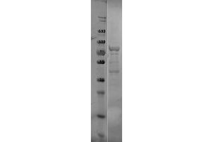 SDS-PAGE of p39 Control Protein. (p39 蛋白)