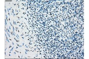 Immunohistochemical staining of paraffin-embedded colon tissue using anti-BUB1Bmouse monoclonal antibody. (BUB1B 抗体)