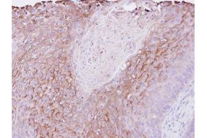 IHC-P Image Immunohistochemical analysis of paraffin-embedded Cal27 xenograft , using PIGR, antibody at 1:500 dilution. (PIGR 抗体)