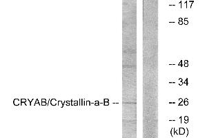 Western blot analysis of extracts from K562 cells, treated with Ca2+ (40nM, 30mins), using CRYAB/Crystallin-α-B (Ab-59) antibody. (CRYAB 抗体)