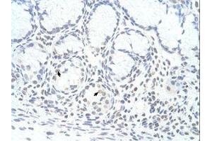 Image no. 1 for anti-Zinc Finger Protein 580 (ZNF580) (AA 31-80) antibody (ABIN6736331) (ZNF580 抗体  (AA 31-80))