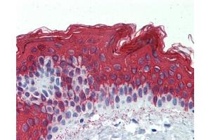 Immunohistochemistry (IHC) image for anti-Keratin 1 (KRT1) (Middle Region) antibody (ABIN2775333) (Cytokeratin 1 抗体  (Middle Region))