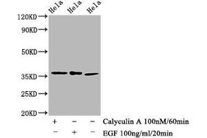 Western Blot Positive WB detected in Hela whole cell lysate(treated with Calyculin A or EGF) All lanes Phospho-EIF2S1 antibody at 1. (Recombinant EIF2S1 抗体  (pSer51))