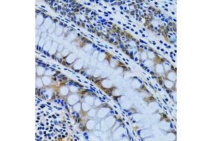 Immunohistochemistry of paraffin-embedded human colon using IMPA1 antibody (ABIN2563424) at dilution of 1:100 (40x lens). (IMPA1 抗体)