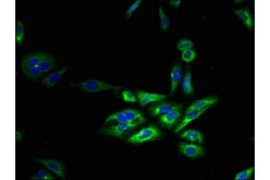 Immunofluorescent analysis of HepG2 cells using ABIN7153167 at dilution of 1:100 and Alexa Fluor 488-congugated AffiniPure Goat Anti-Rabbit IgG(H+L) (FFAR3 抗体  (AA 280-346))