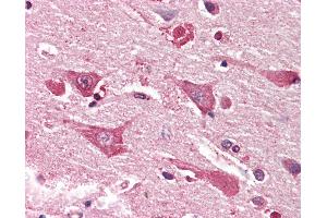 Anti-MYO1B / Myosin IB antibody IHC staining of human brain, cortex. (Myosin IB 抗体  (AA 327-339))