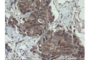 Image no. 12 for anti-Prefoldin Subunit 3 (PFDN3) antibody (ABIN1501702)