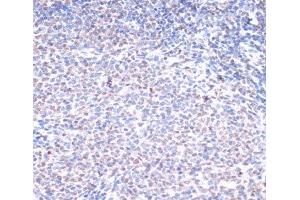 Immunohistochemistry (Paraffin-embedded Sections) (IHC (p)) image for anti-Breast Cancer 1 (BRCA1) (pSer1423) antibody (ABIN7265138)