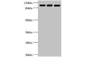 Western blot All lanes: 116 kDa U5 small nuclear ribonucleoprotein component antibody at 3 μg/mL Lane 1: Hela whole cell lysate Lane 2: 293T whole cell lysate Lane 3: NIH/3T3 whole cell lysate Secondary Goat polyclonal to rabbit IgG at 1/10000 dilution Predicted band size: 47, 44, 37 kDa Observed band size: 109 kDa (EFTUD2 抗体  (AA 1-205))