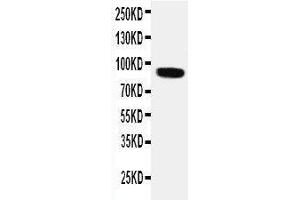 Western Blotting (WB) image for anti-Transient Receptor Potential Cation Channel, Subfamily V, Member 2 (TRPV2) (AA 42-624), (N-Term) antibody (ABIN3044039)