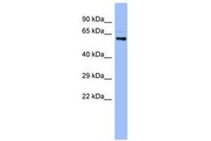 Image no. 1 for anti-Cytochrome P450, Family 4, Subfamily A, Polypeptide 22 (CYP4A22) (AA 35-84) antibody (ABIN6741748) (CYP4A22 抗体  (AA 35-84))