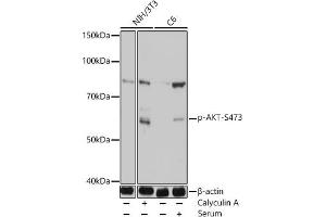 Western blot analysis of extracts of various cell lines, using Phospho-Akt-S473 antibody (ABIN7265523) at 1:1000 dilution. (AKT 1/2/3 抗体  (pSer472))