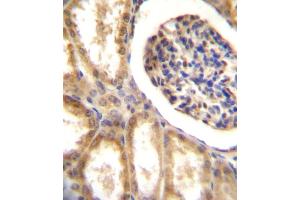 DDR1 Antibody (N-term) A immunohistochemistry analysis in formalin fixed and paraffin embedded human kidney tissue followed by peroxidase conjugation of the secondary antibody and DAB staining. (DDR1 抗体  (N-Term))