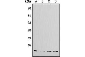 Western blot analysis of Amylin expression in MCF7 (A), HeLa (B), mouse kidney (C), rat kidney (D) whole cell lysates. (Amylin/DAP 抗体  (N-Term))