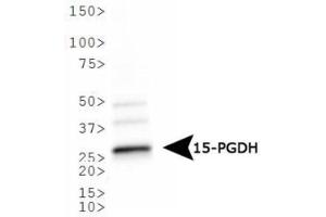 Image no. 2 for anti-Hydroxyprostaglandin Dehydrogenase 15-(NAD) (HPGD) antibody (ABIN363465) (HPGD 抗体)