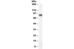 Western blot testing of human liver lysate with CPT1A antibody at 0. (CPT1A 抗体)