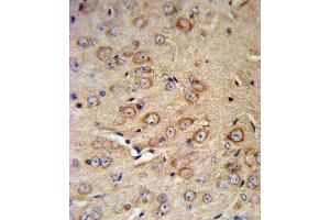 Immunohistochemistry (Paraffin-embedded Sections) (IHC (p)) image for anti-Corticotropin Releasing Hormone Receptor 2 (CRHR2) (AA 84-114), (N-Term) antibody (ABIN390757)