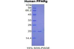 SDS-PAGE analysis of Human PPARG Protein. (PPARG 蛋白)