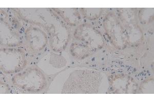 Detection of TAGLN2 in Human Kidney Tissue using Polyclonal Antibody to Transgelin 2 (TAGLN2) (TAGLN2 抗体  (AA 2-199))