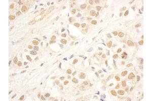 Immunohistochemistry (IHC) image for anti-NOP58 Ribonucleoprotein (NOP58) (AA 350-400) antibody (ABIN7453505)