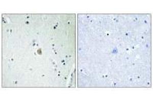 Immunohistochemistry (IHC) image for anti-Cytochrome P450, Family 2, Subfamily E, Polypeptide 1 (CYP2E1) (C-Term) antibody (ABIN7180154)