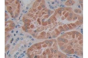 Immunohistochemistry (IHC) image for anti-SP140 Nuclear Body Protein (SP140) (AA 443-655) antibody (ABIN7442387)